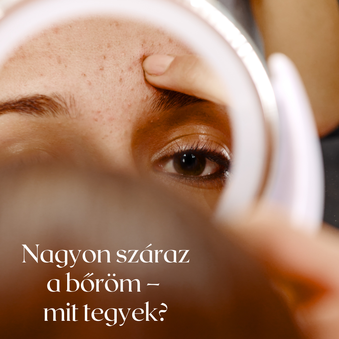 💧 Nagyon száraz a bőröm – mit tegyek?