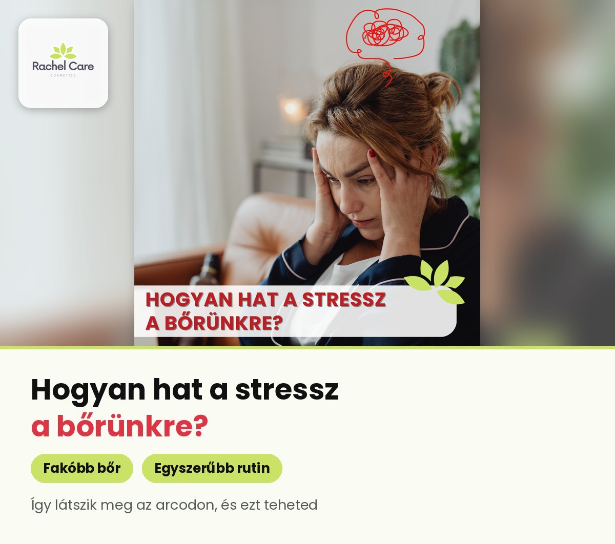 Stresszes nő a fejét fogja a kanapén – hogyan hat a stressz a bőrre