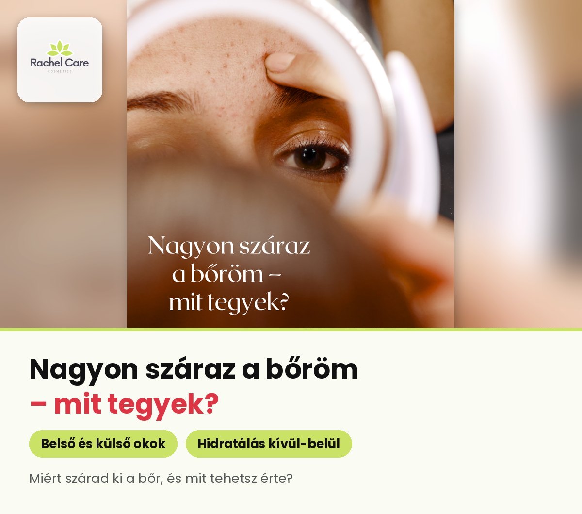 Szeplős nő szeme egy kerek tükör mögül – nagyon száraz bőr, mit tegyek